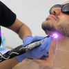 زراعة شعر ازاله شعر بلليزر تنظيف بشرى بلكريستال