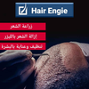 زراعة شعر ازاله شعر بلليزر تنظيف بشرى بلكريستال